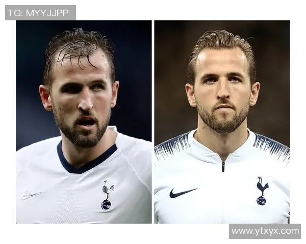 足球明星脱发问题揭秘这些球员的发量令人担忧